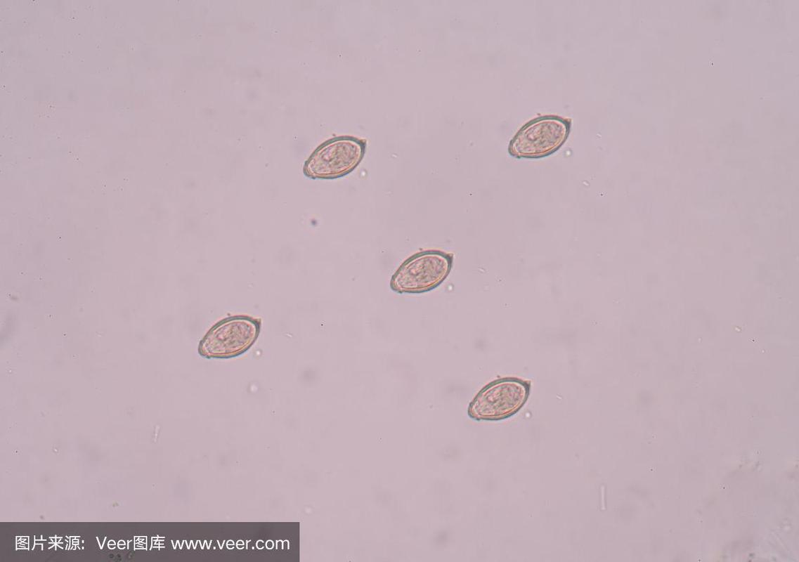 新澳今天最新消息和自来水中含活体虫与自来水中含活体虫吗